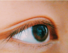 倒睫是由什么原因引起的？