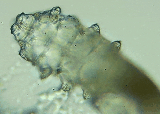 睫毛上驚現(xiàn)80只螨蟲！別揉了，快自查下你的眼睛有沒有......